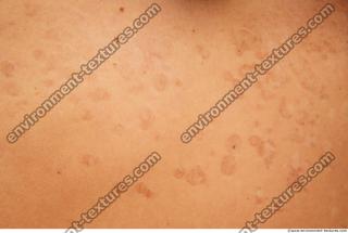 Photo Textures of Human Skin